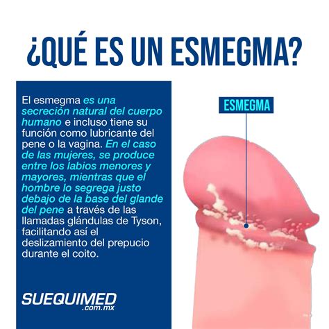 que es esmegma|Esmegma